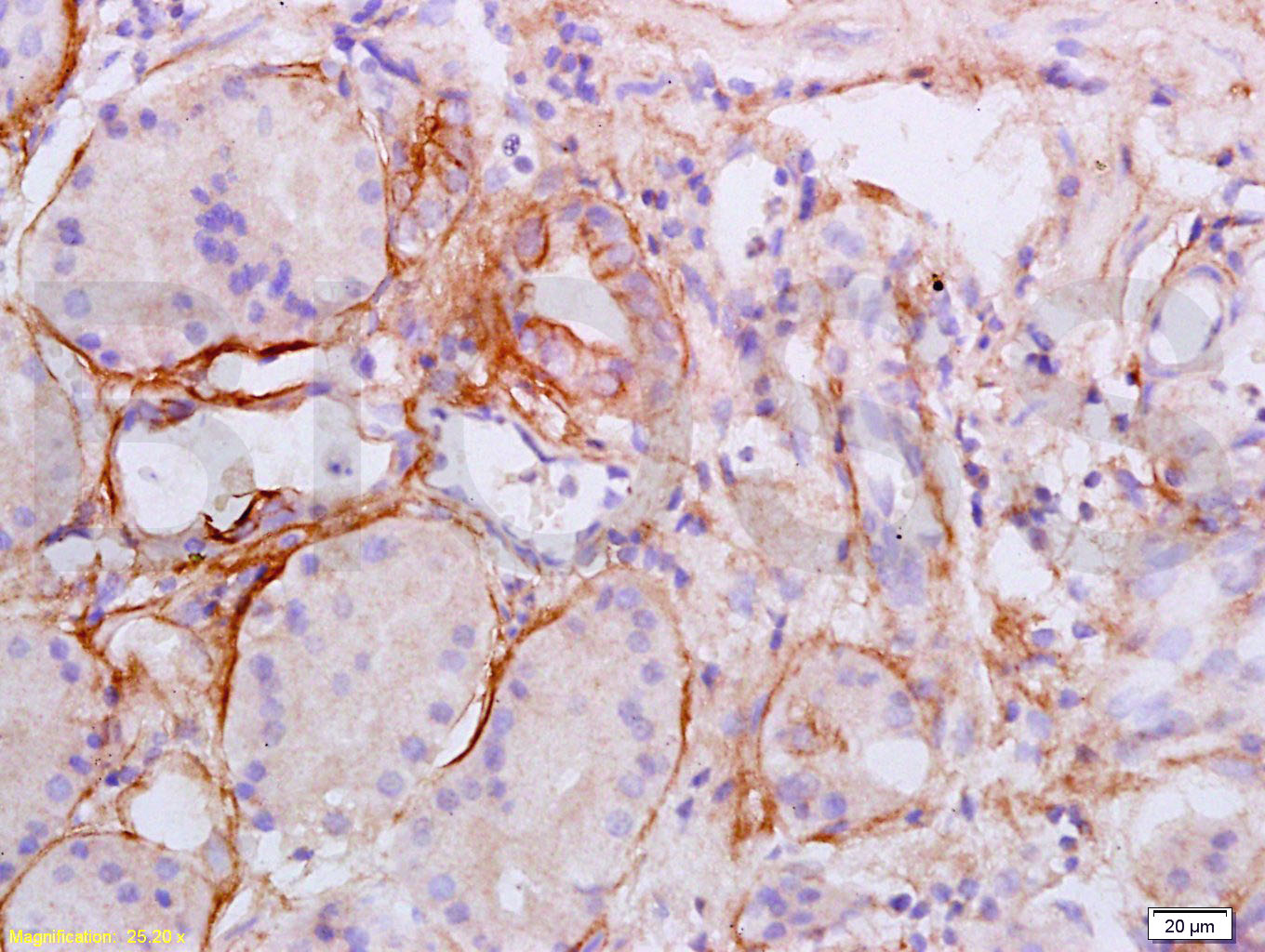 Collagen  II Rabbit pAb(bs-070