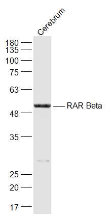 RARB Rabbit pAb(bs-0516R)-50ul