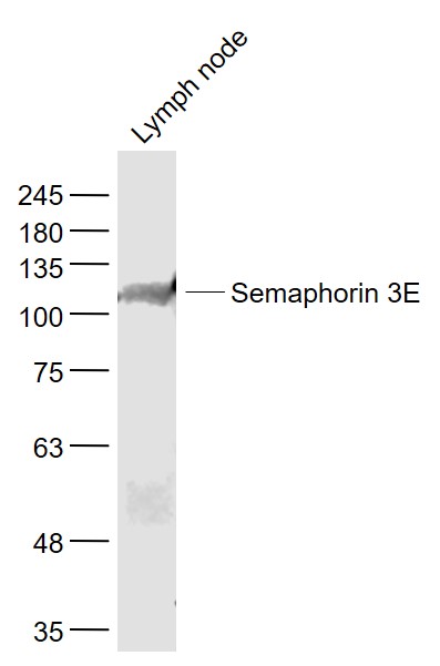 Semaphorin 3E Rabbit pAb(bs-11