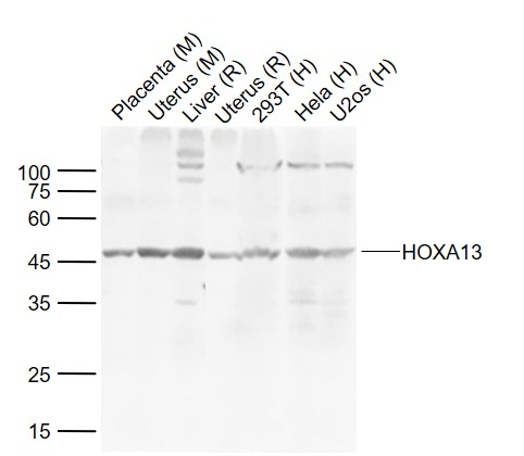 HOXA13 Rabbit pAb(bs-12244R)-5