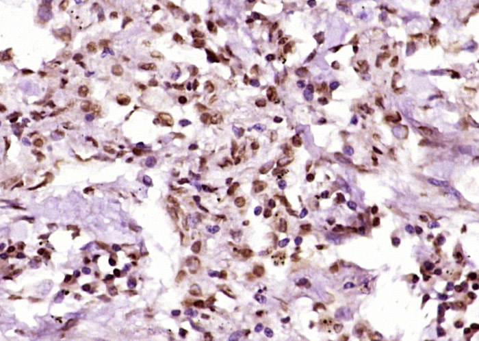 AMPK beta 1/PRKAB1 Rabbit pAb(