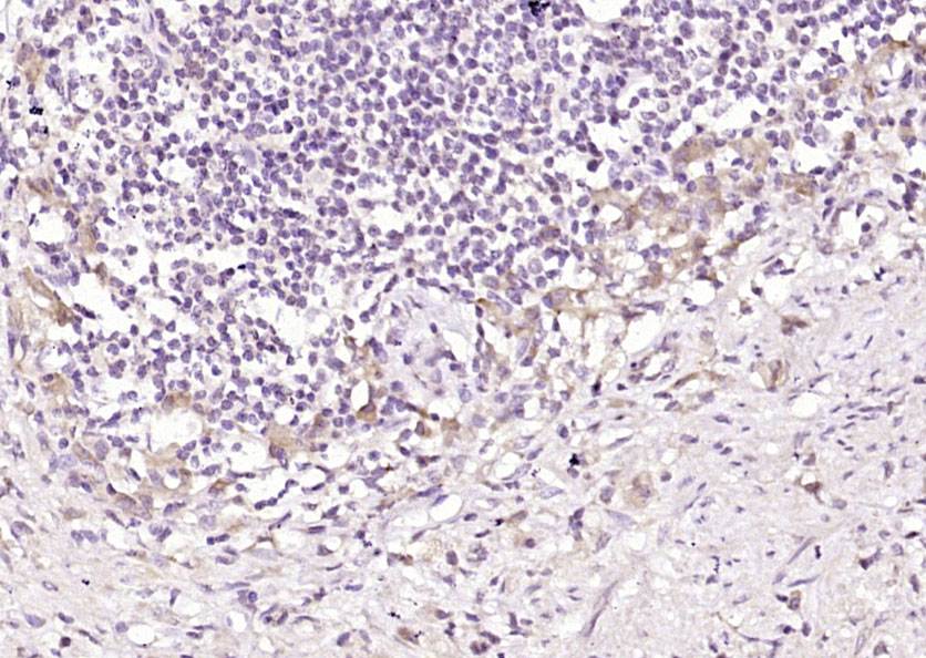 DENND2D Rabbit pAb(bs-9668R)-5