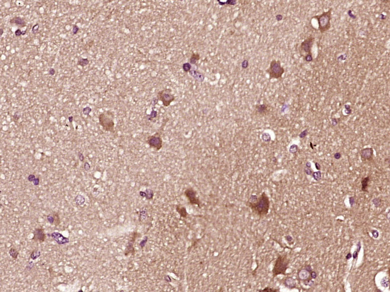 phospho-Smad1 (Ser206) Rabbit 