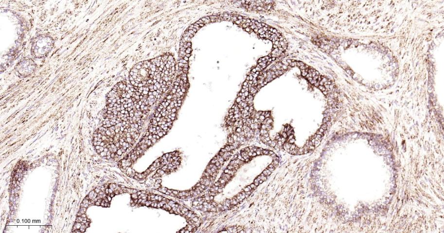 SDHB Recombinant Rabbit mAb(bs
