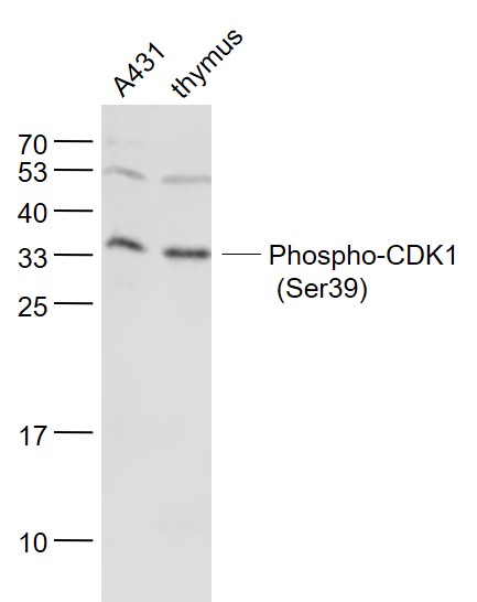 phospho-CDK1 (Ser39) Rabbit pA