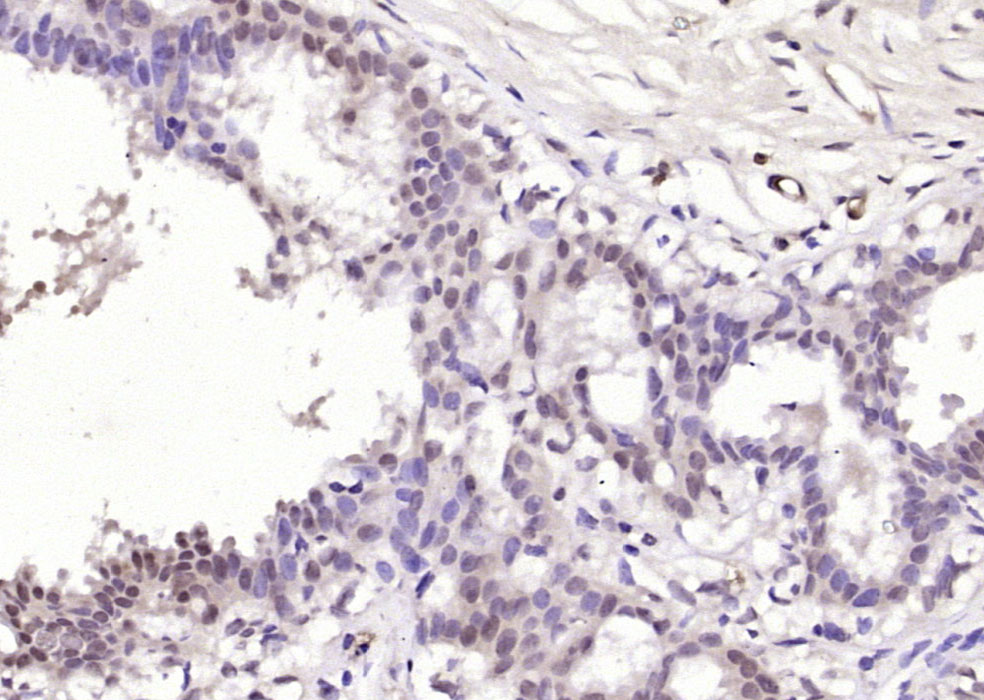 AMIGO2 Rabbit pAb(bs-11450R)-5