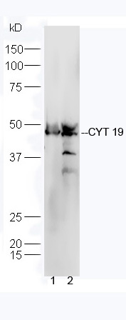 CYT 19 Rabbit pAb(bs-10633R)-5