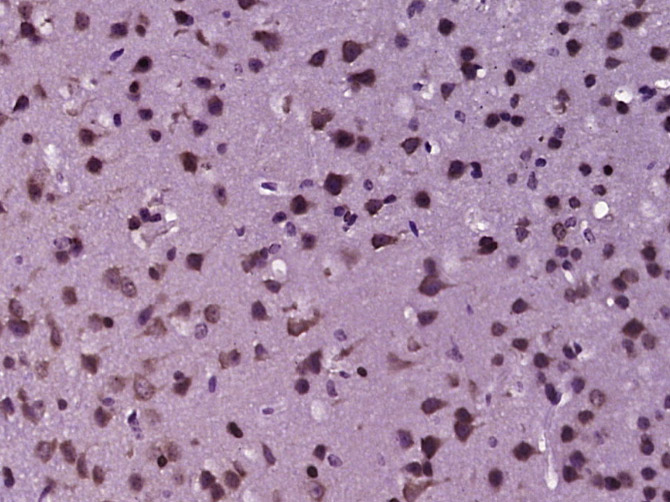 OAS3 Rabbit pAb(bs-7344R)-50ul