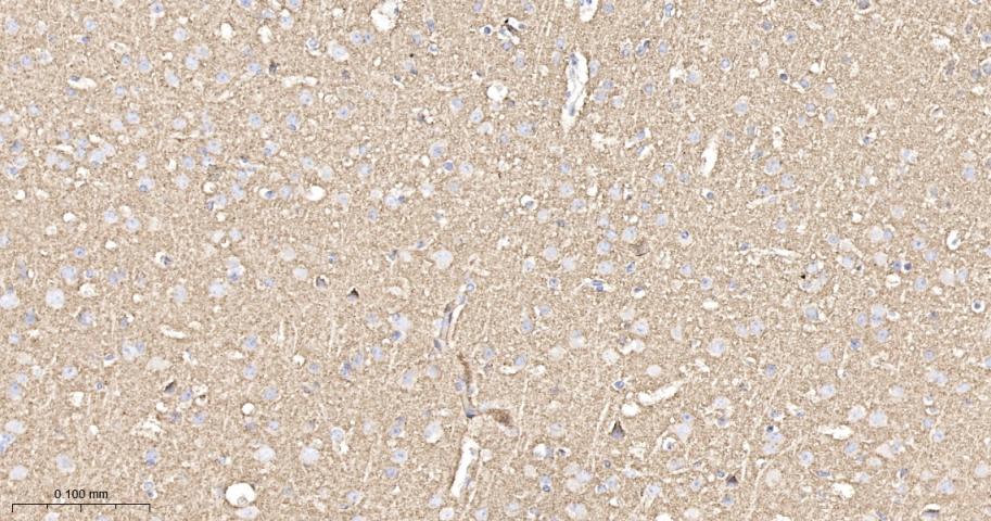 Synaptophysin Recombinant Rabb