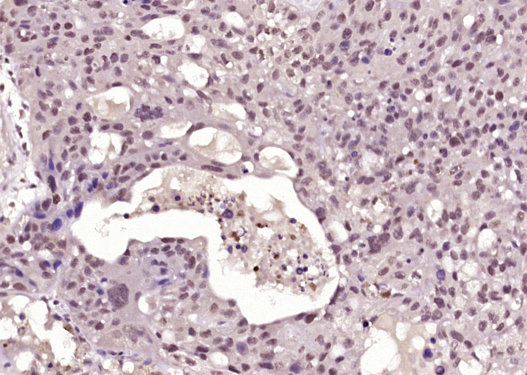 phospho-BRCA1 (Ser1423) Rabbit