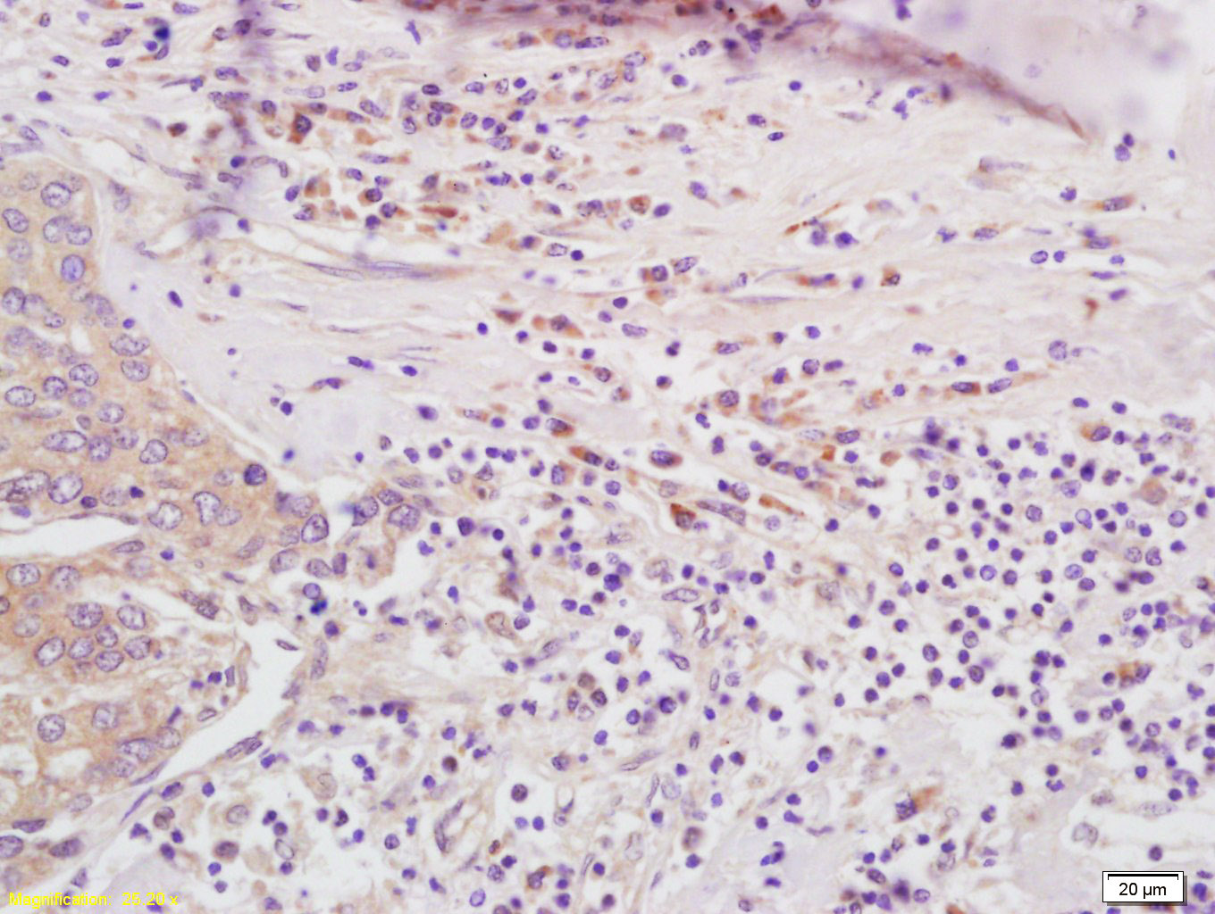 PSMB8 Rabbit pAb(bs-9364R)-50u