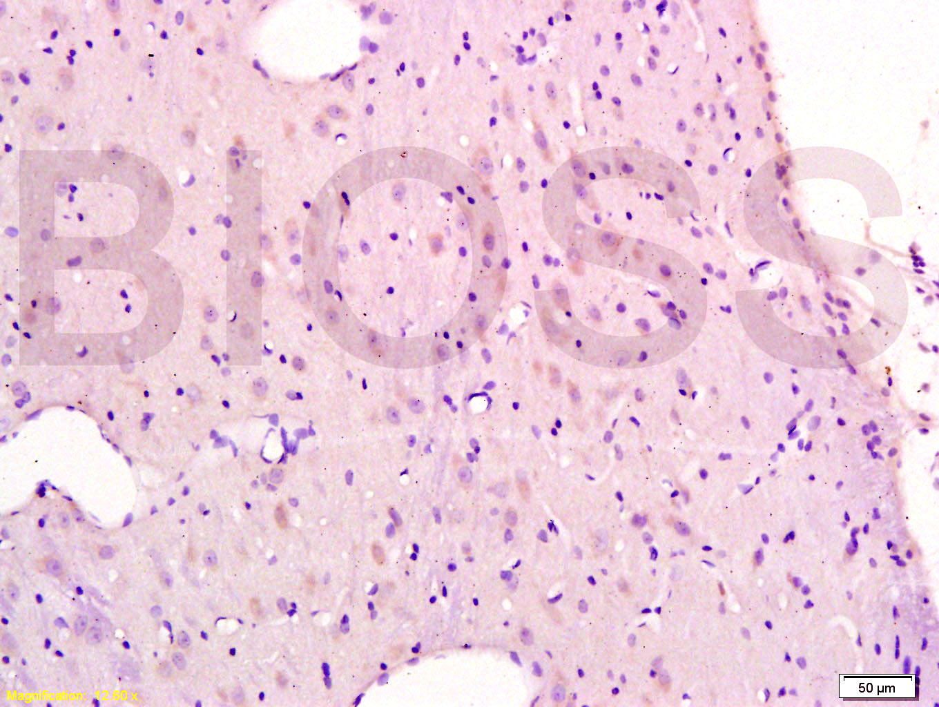 5HT1B Receptor Rabbit pAb(bs-1