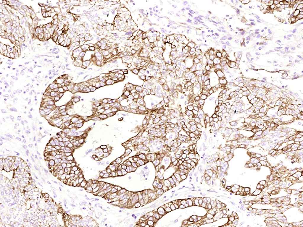 Cytokeratin 8(Ready to use) Mo
