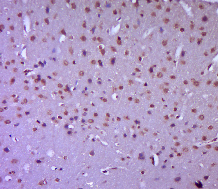 Plzf Rabbit pAb(bs-5971R)-50ul