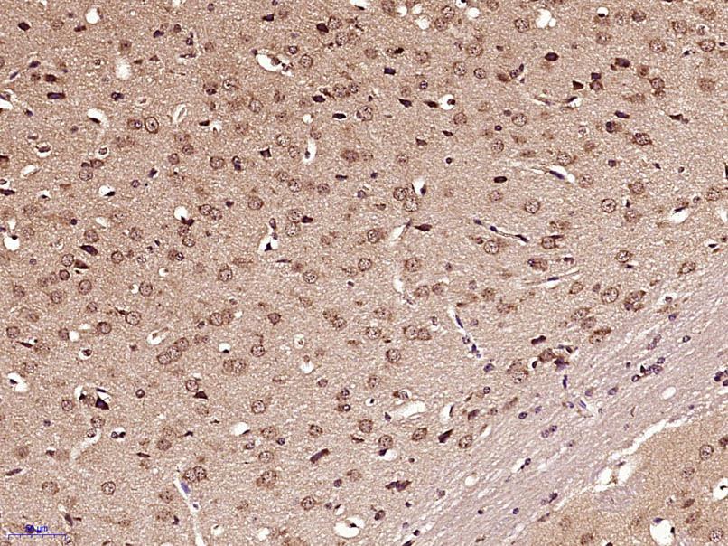 GLI1 Rabbit pAb(bs-1206R)-50ul