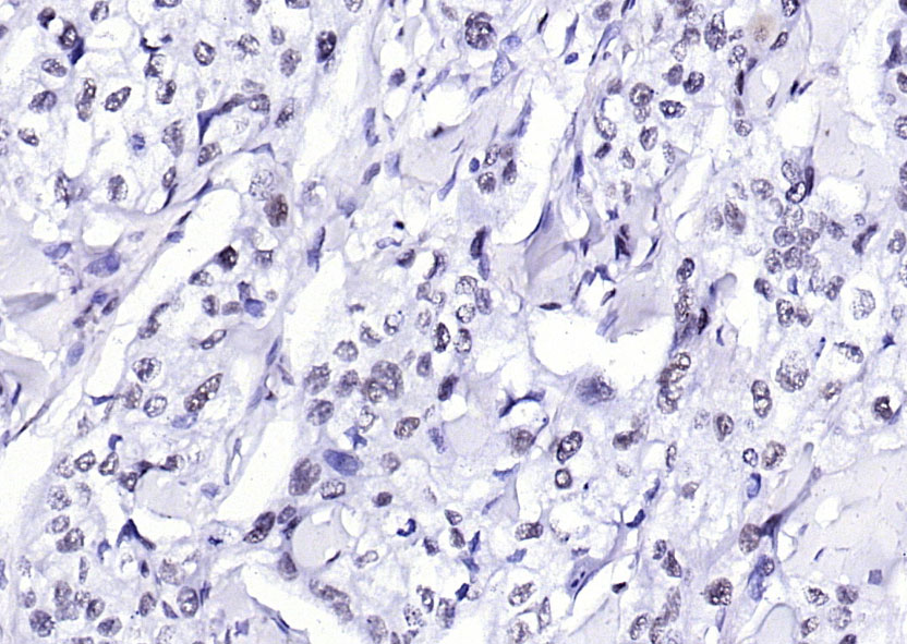 phospho-H2AX (Tyr143) Rabbit p