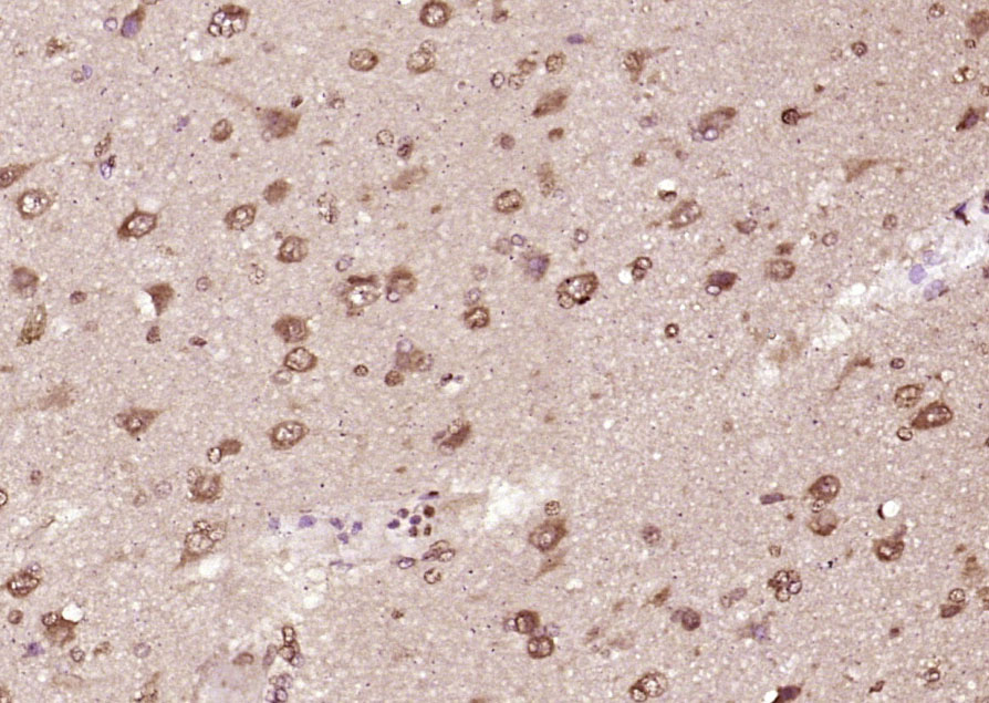 INTS3 Rabbit pAb(bs-9766R)-50u