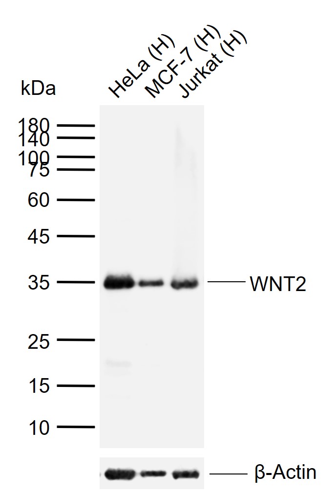 WNT2 Rabbit pAb(bs-6133R)-50ul