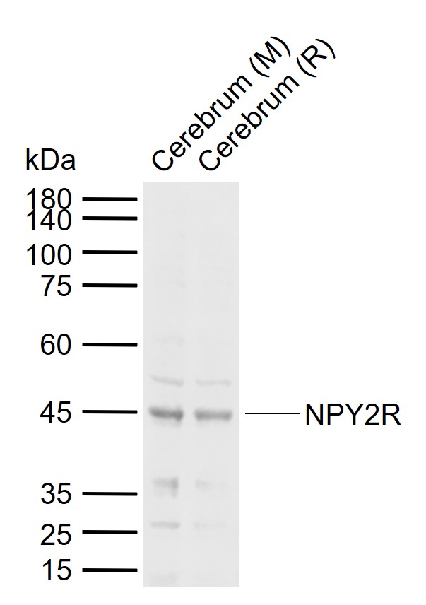NPY2R Rabbit pAb(bs-0937R)-50u