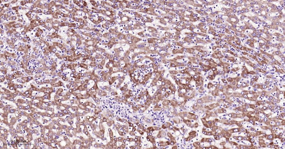 CPT1A Rabbit pAb(bs-2047R)-50u