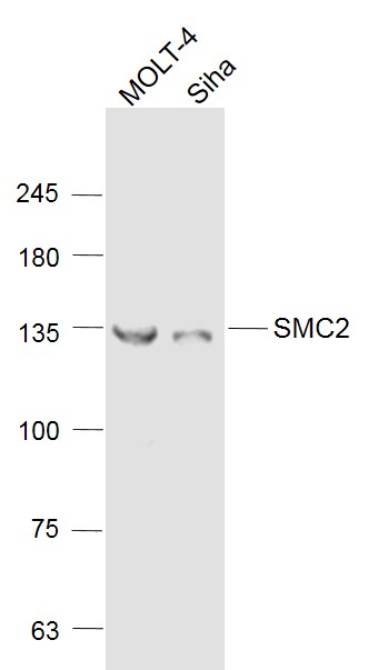 SMC2 Rabbit pAb(bs-7727R)-50ul