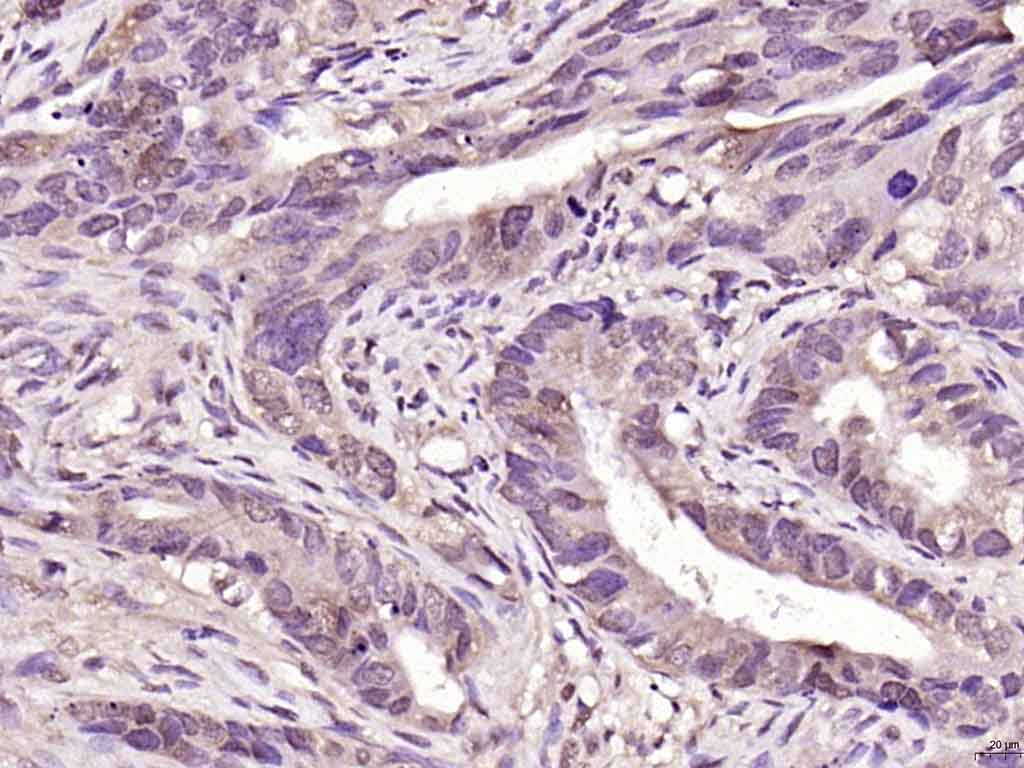 PARK7/DJ1 Rabbit pAb(bs-1306R)