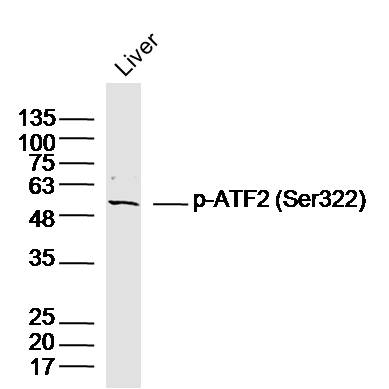 phospho-ATF2 (Ser322) Rabbit p