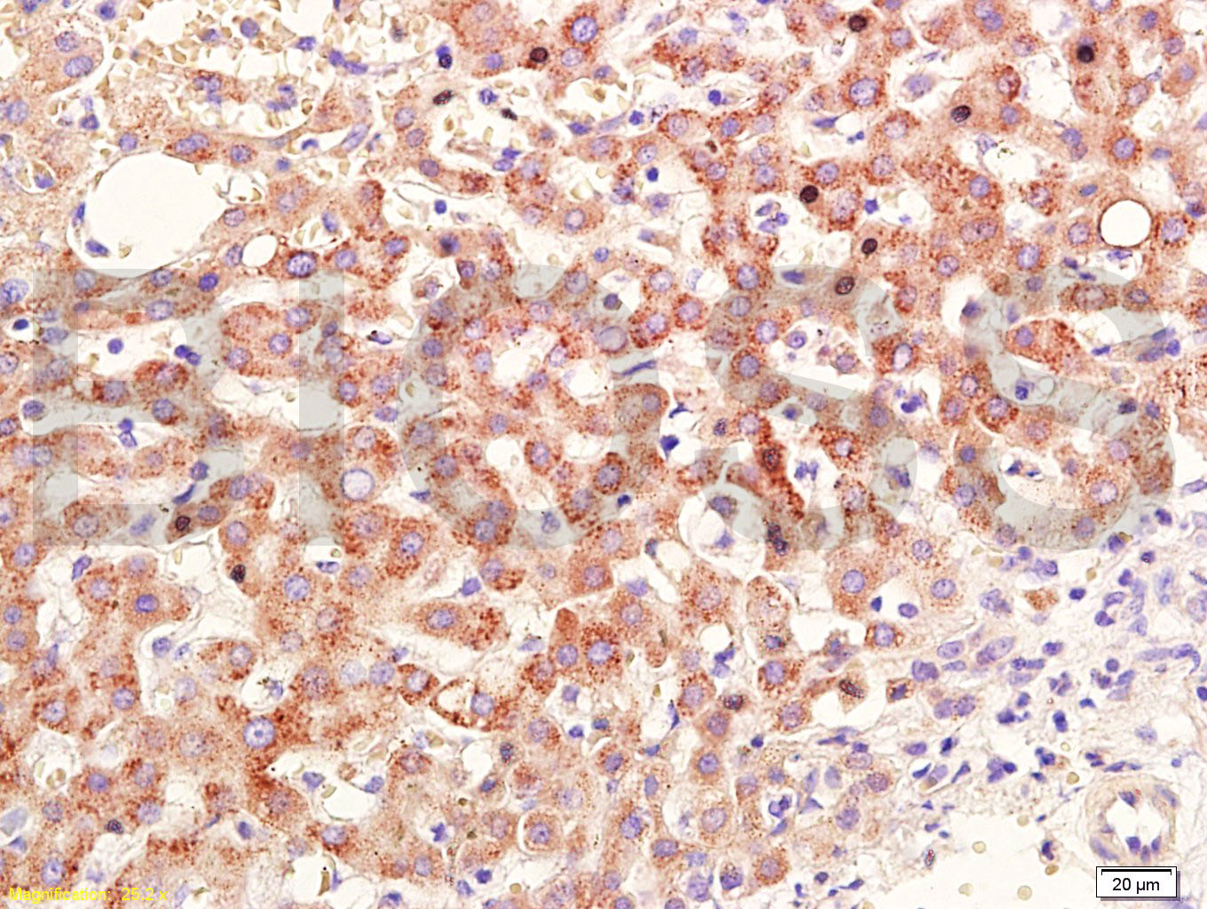 RARB Rabbit pAb(bs-0516R)-50ul