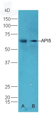 API5 Rabbit pAb(bs-1252R)-50ul