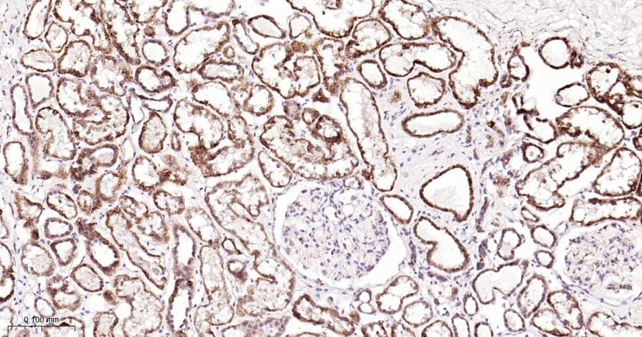 SDHB Recombinant Rabbit mAb(bs