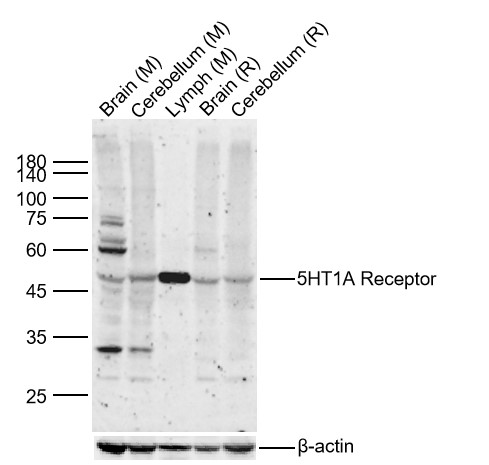 5HT1A Receptor Rabbit pAb(bs-1