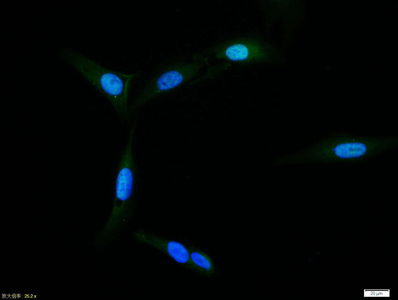 SMAD7 Rabbit pAb(bs-0566R)-50u