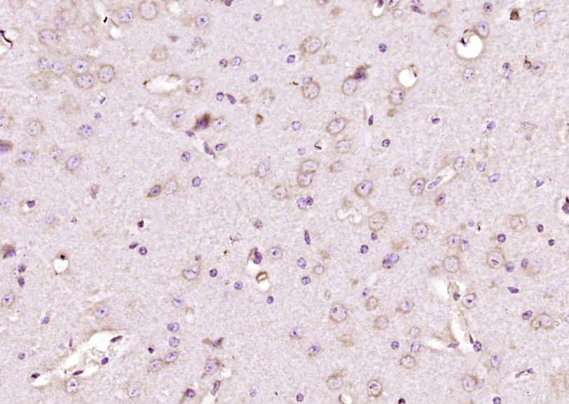 CK II beta Rabbit pAb(bs-21820