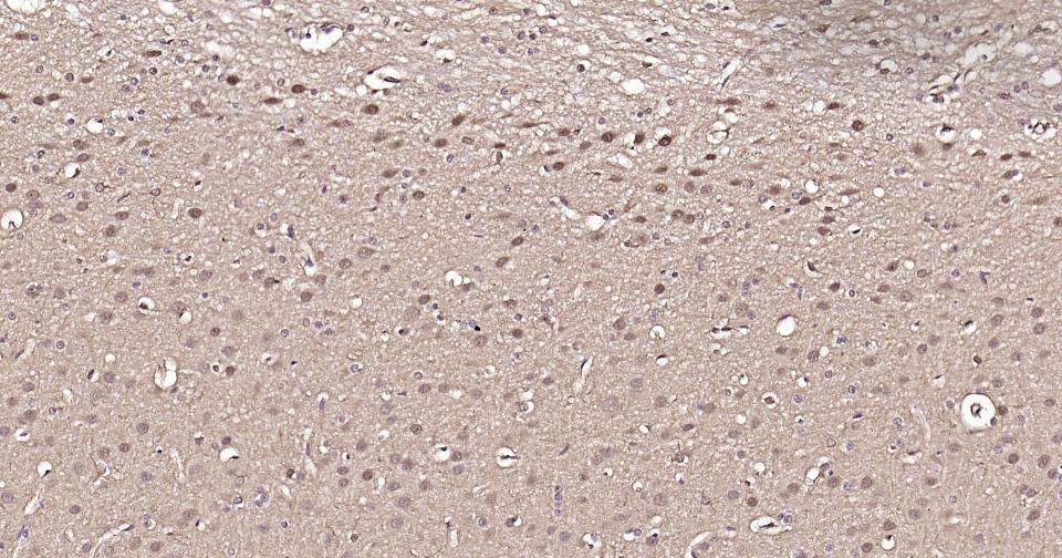 GAPDH Rabbit pAb, Loading Cont