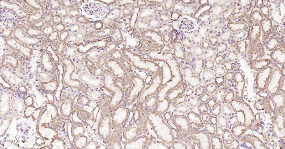 SDHB Recombinant Rabbit mAb(bs