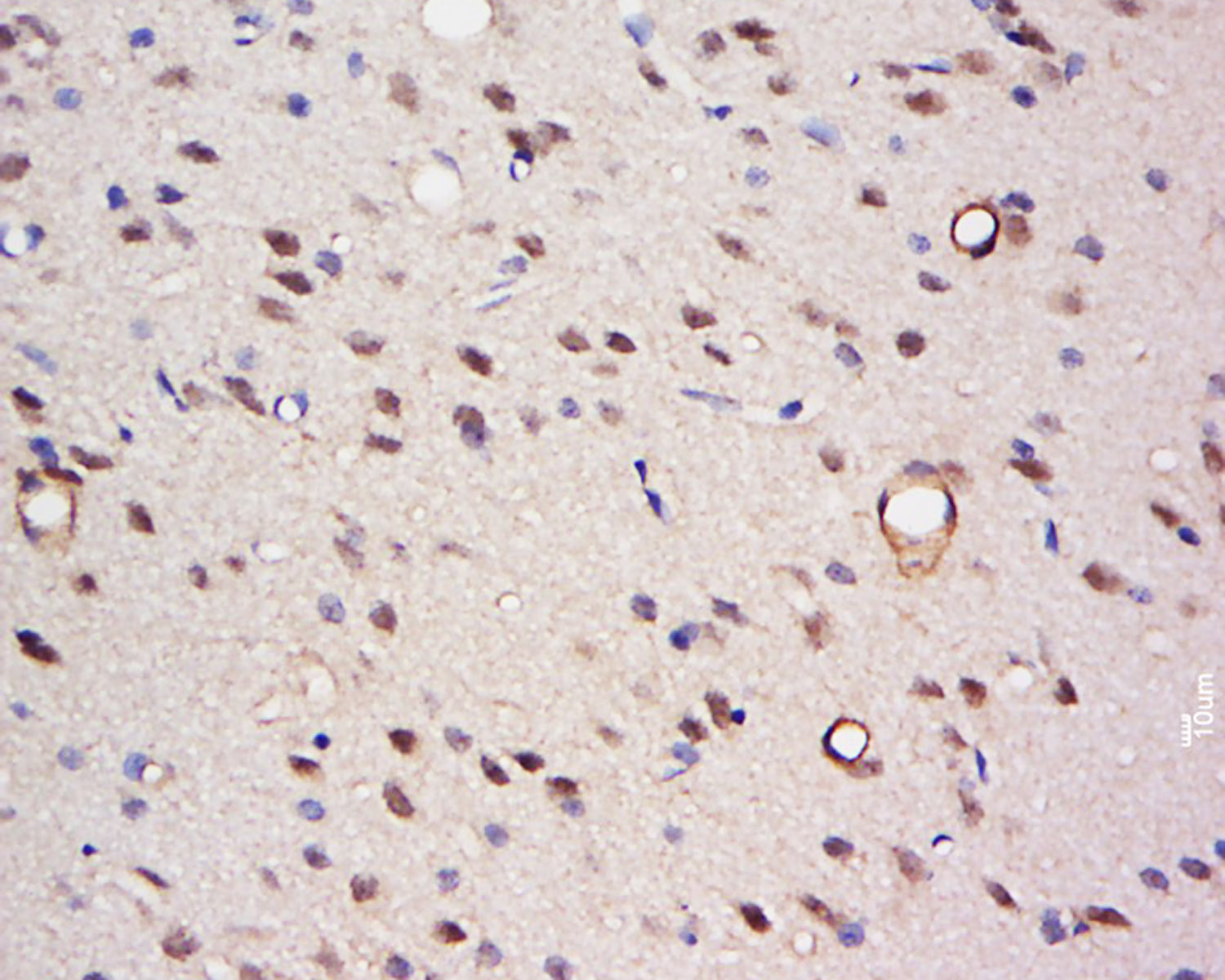 TFCP2C Rabbit pAb(bs-9852R)-50