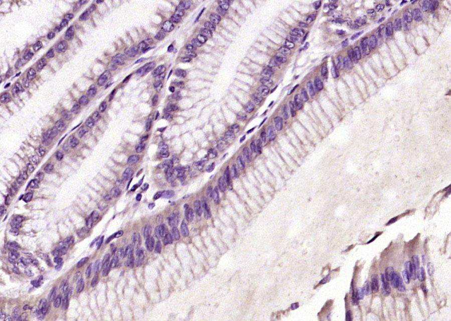 ELAC2/HPC2 Rabbit pAb(bs-4276R