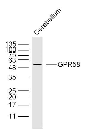 GPR58 Rabbit pAb(bs-13541R)-50