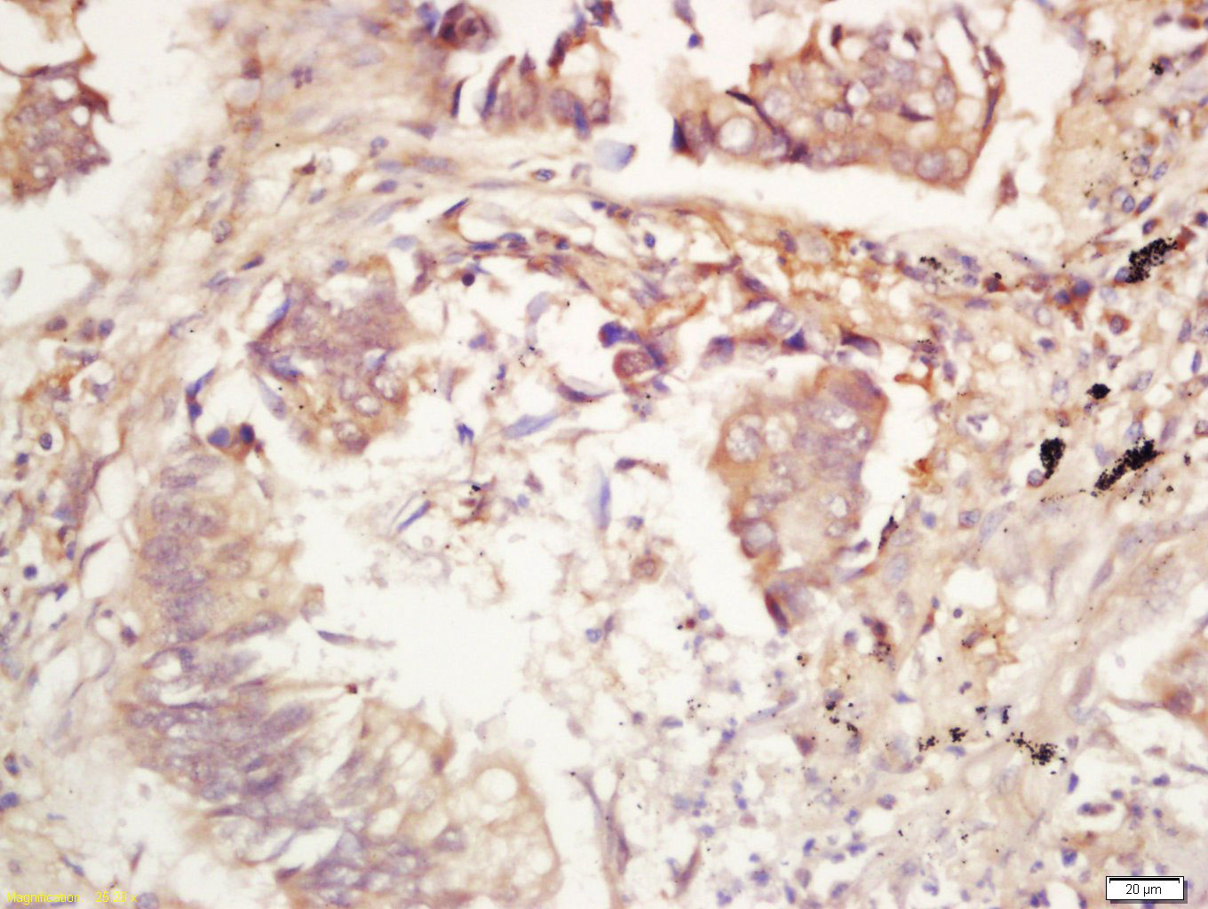 IL17E Rabbit pAb(bs-10943R)-50