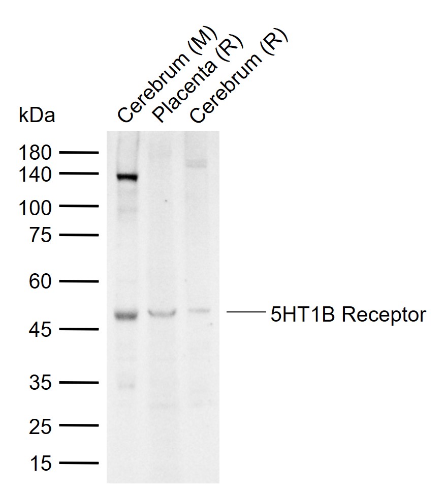 5HT1B Receptor Rabbit pAb(bs-1