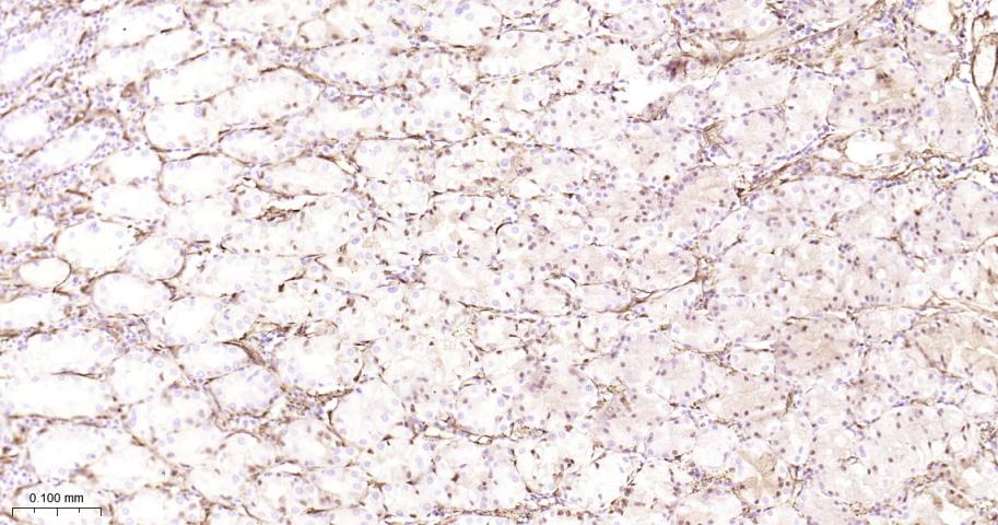 Hsp27 Recombinant Rabbit mAb(b