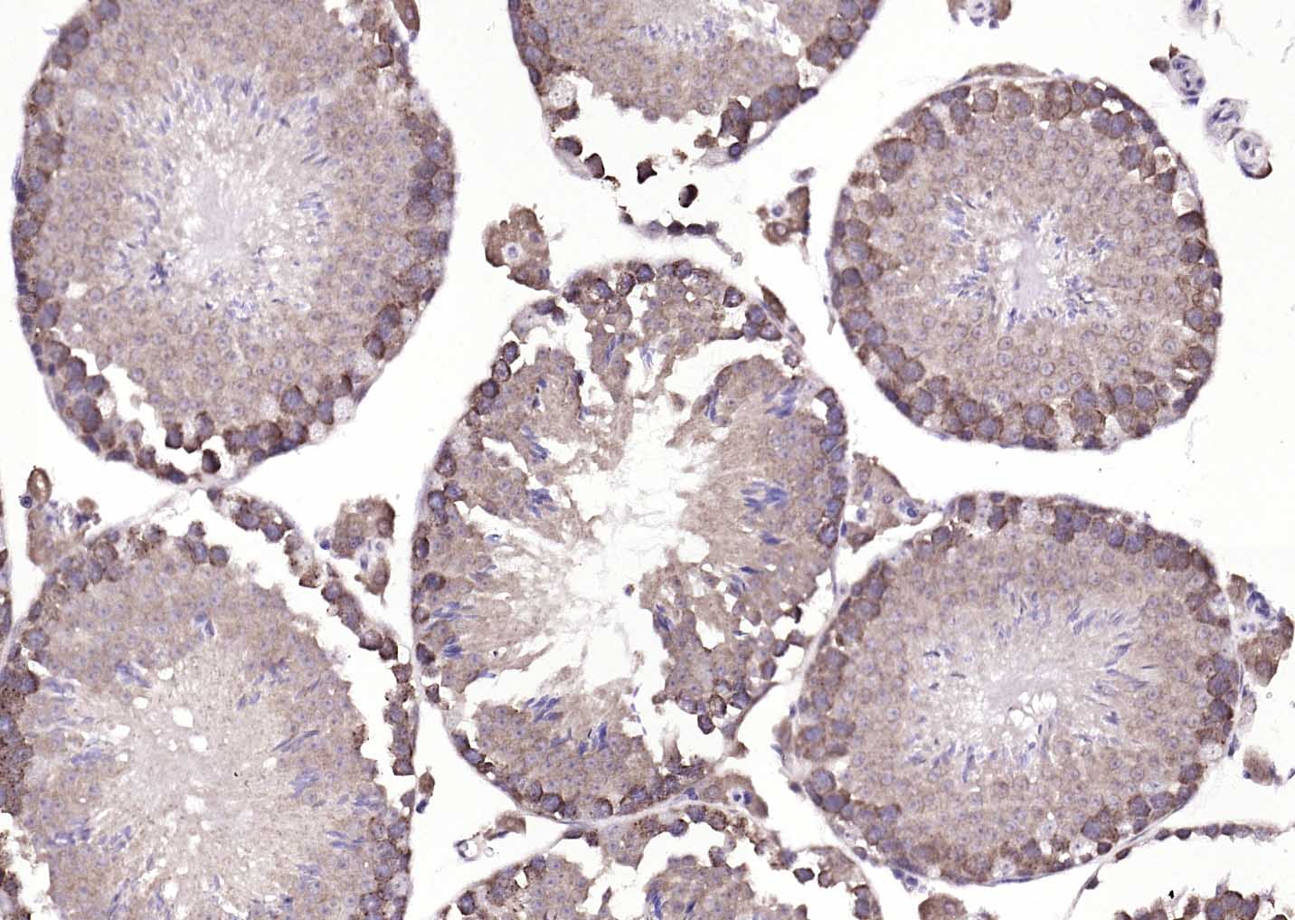 ATP7B Rabbit pAb(bs-1718R)-50u