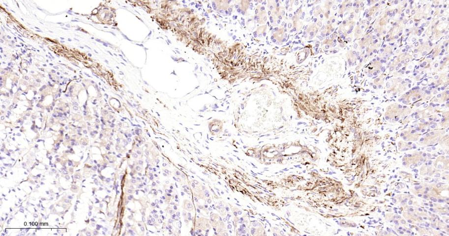 Hsp27 Recombinant Rabbit mAb(b