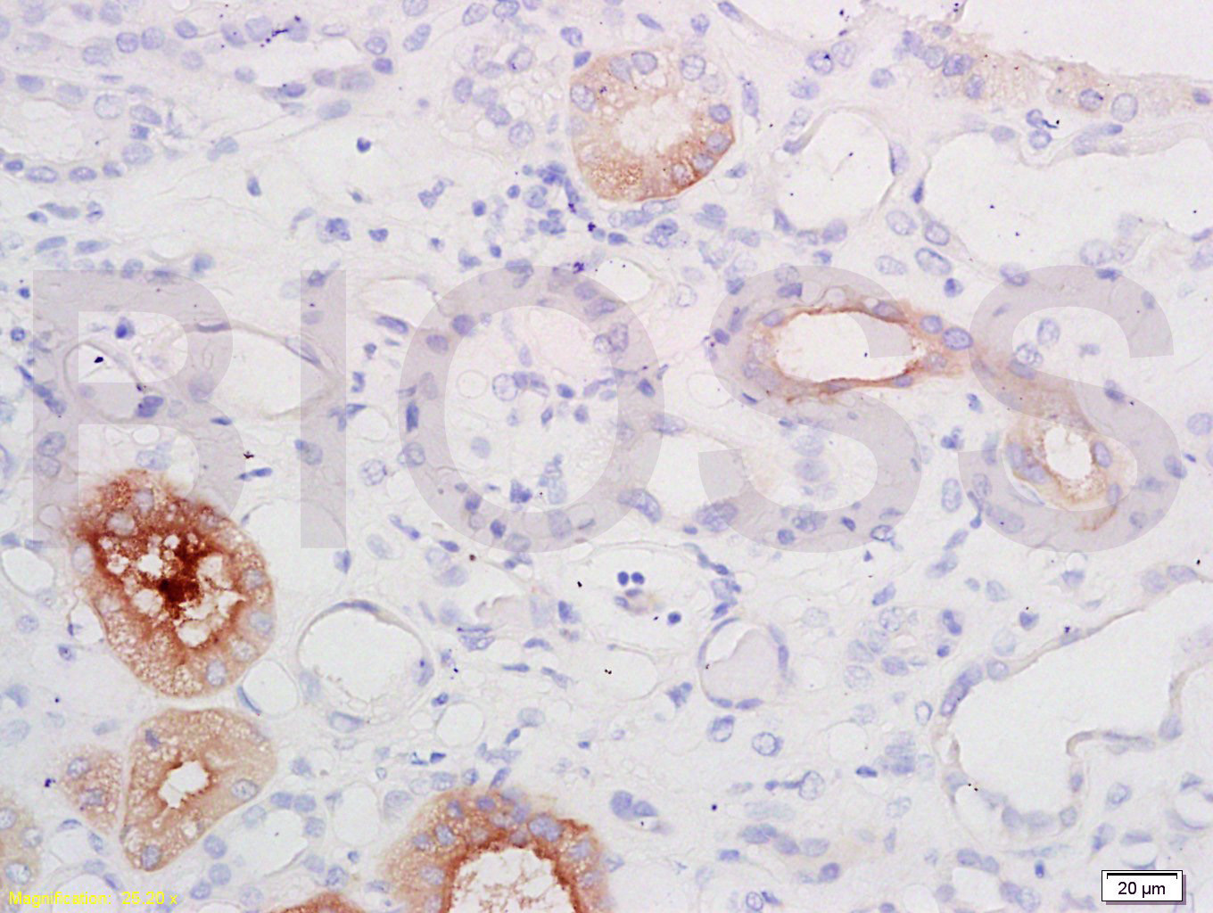 Thrombomodulin Rabbit pAb(bs-0