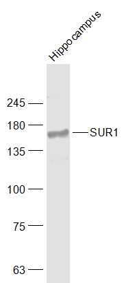SUR1 Rabbit pAb(bs-3641R)-50ul