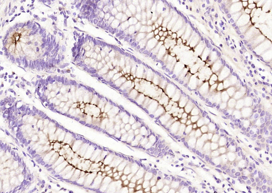 MUC1 Rabbit pAb(bs-1497R)-50ul