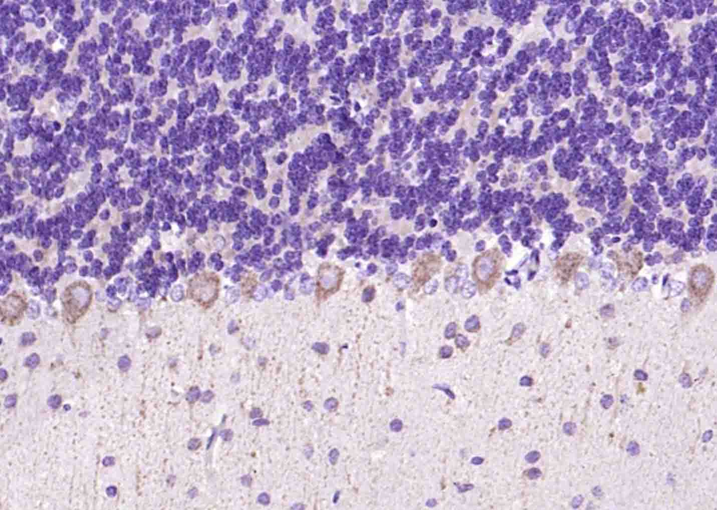 phospho-LIMK1 (Thr508) + LIMK2