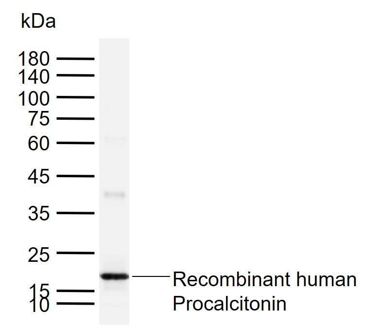Procalcitonin (PCT) Mouse mAb(