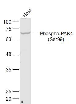 phospho-PAK4 (Ser99) Rabbit pA