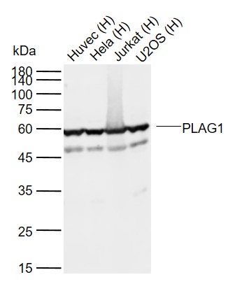 PLAG1 Rabbit pAb(bs-5969R)-50u